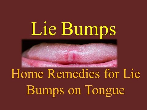 lie bumps