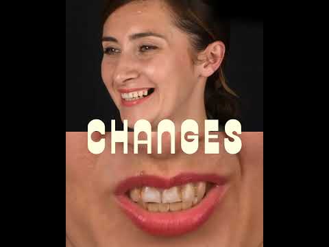 🥹➡️😁 Cómo cambia la cara. Cómo cambia la sonrisa. Cómo cambia la vida