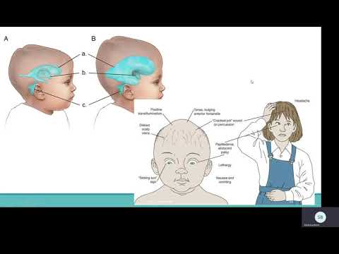 Video: Intrakranijinis Slėgis - Priežastys, Simptomai Ir Gydymas