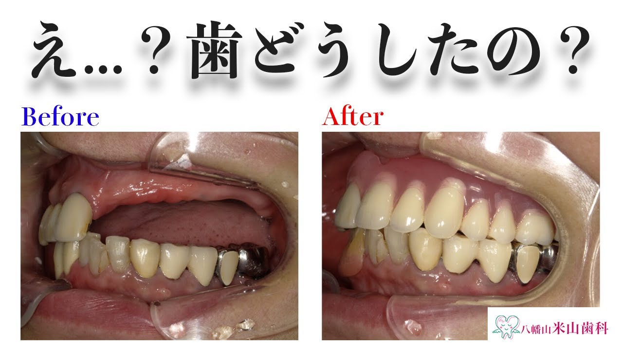 【衝撃】1人の人生を変えた治療