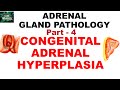 Adrenal Gland Pathology: Part -4. CONGENITAL ADRENAL HYPERPLASIA