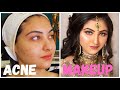 How to Cover Acne | Nikah Makeup No Liner | Glamours Makeup look | farah salon