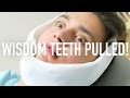 GETTING MY WISDOM TEETH PULLED!