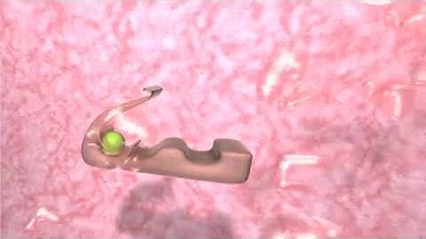 Inhibiting the function of an enzyme