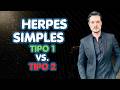 HERPES SIMPLES Tipo 1 vs. Tipo 2!