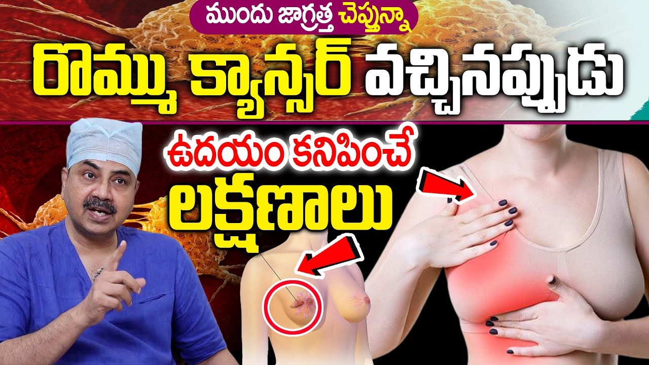 రొమ్ము కాన్సర్ లక్షణాలు || Breast Cancer || Dr.Mohan Vamsi About Cancer || iD Health 360