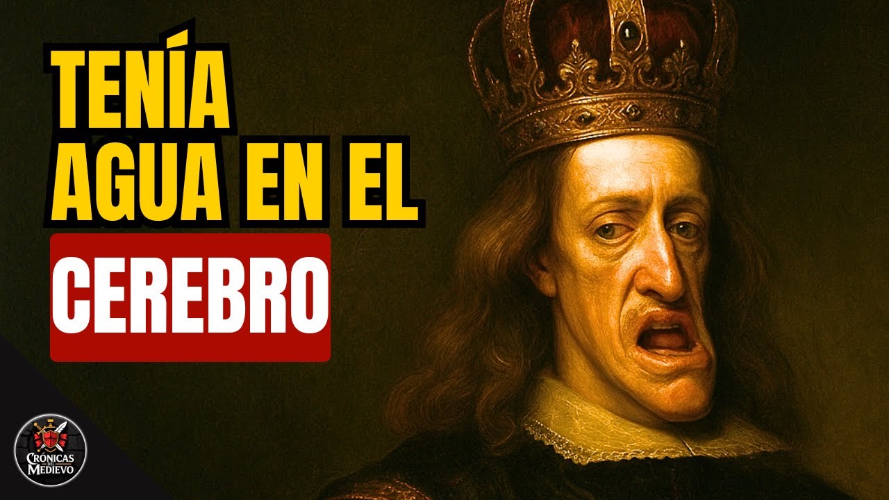 Carlos II: El Rey con Huesos Líquidos y el Cerebro Inundado