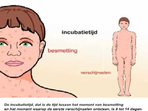 Video: Hoe het mazelen-, bof- en rubella-vaccin (MMR) te geven?