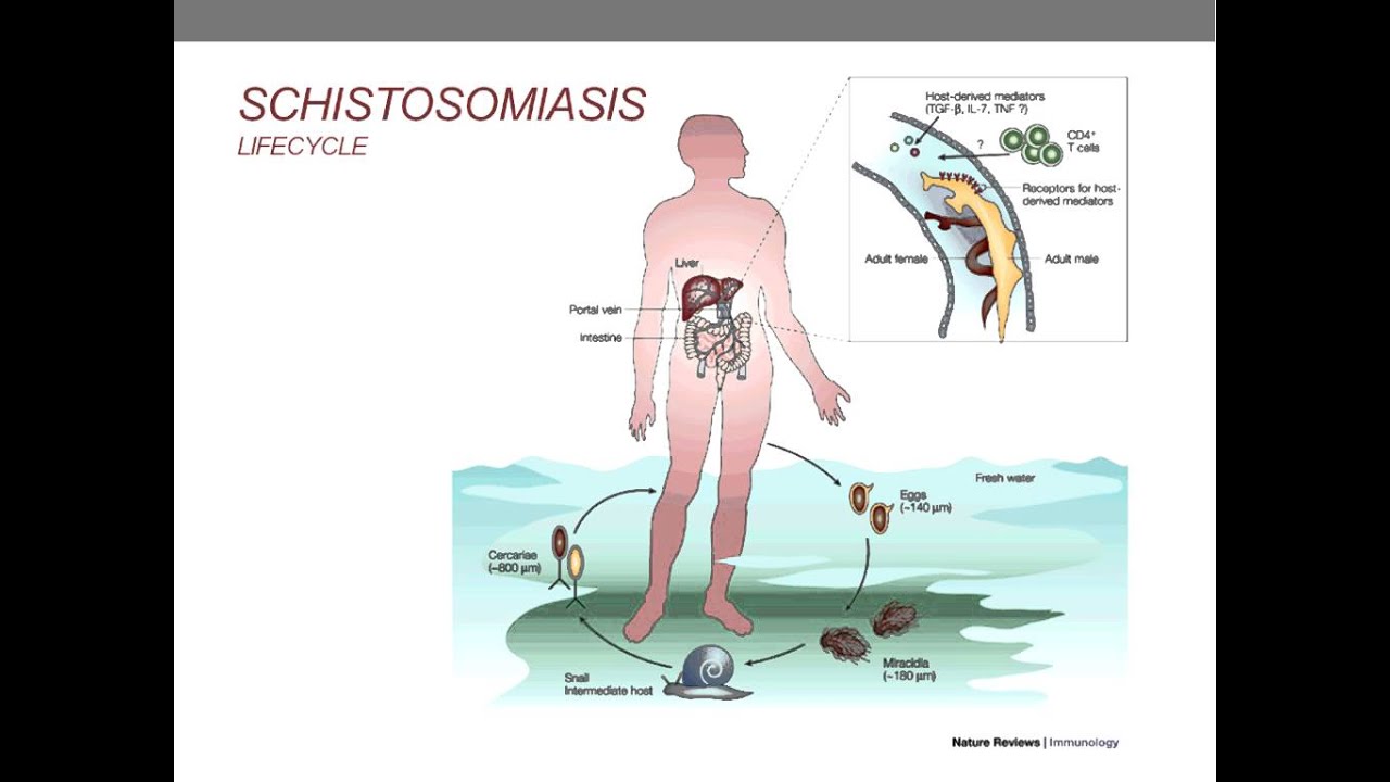 típusú schistosomiasis)