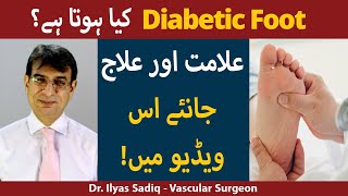 What is Diabetic Foot? | Causes, Symptoms and Treatment of Diabetic Foot in Urdu/Hindi