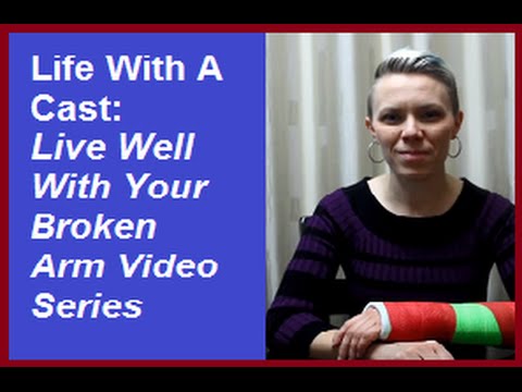 VIDEO: Caring for your cast, Tips to help your limb heal