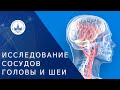 🔬 Показания для исследования сосудов головы и шеи. Исследование сосудов головы и шеи. МНОЦ МГУ. 18+