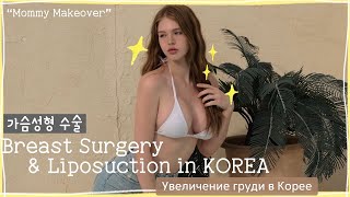 Mommy makeover: Восстановление фигуры после ребенка. Увеличение груди и липосакция в Корее