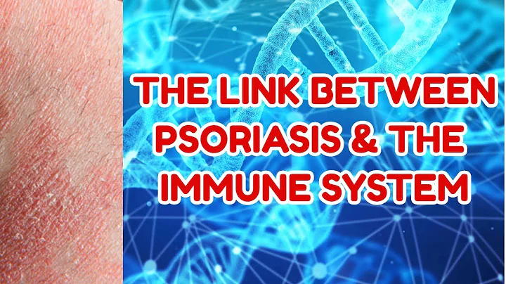 The Link Between Psoriasis And The Immune System - Heal Psoriasis Holistically