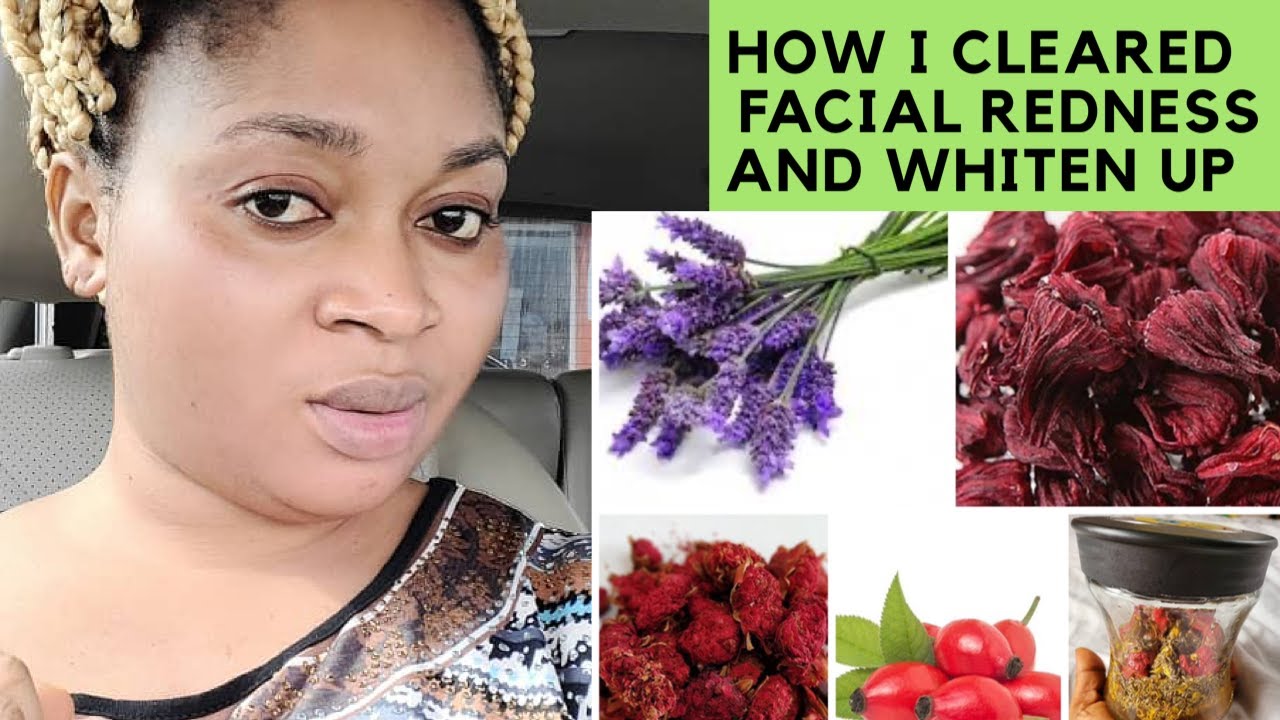 toner makes face red