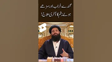 Gande Kharab Aur Sarey Hway Zakham Ka Akhri Ilaj Ubqari Tasbeeh Khana Short 
