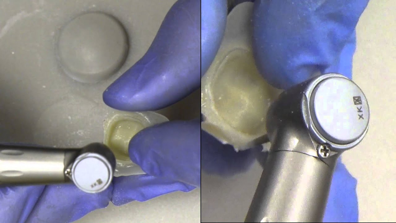 Dr.  Ywom Provisional Crown Prep