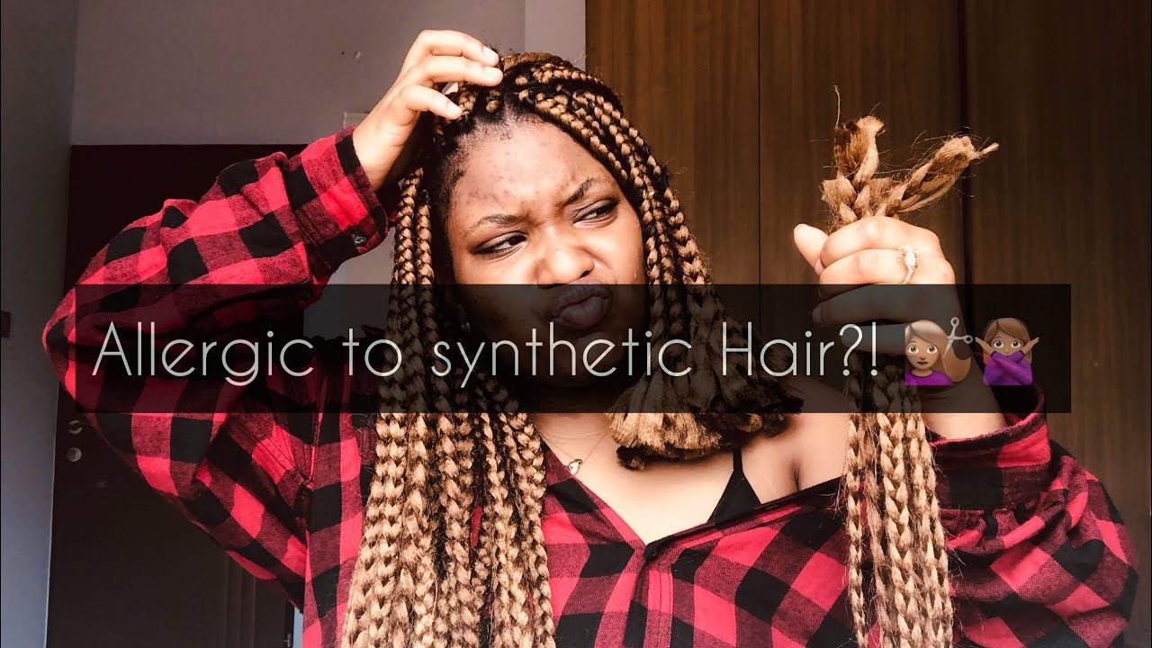 BOX BRAIDS GONE BAD Allergic to SYNTHETIC hair? YouTube