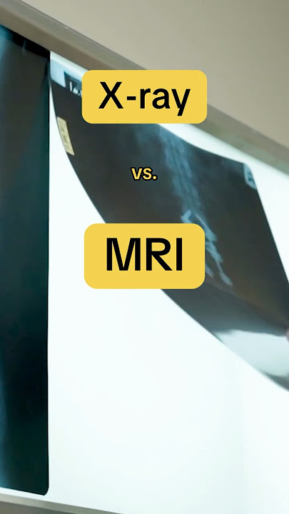 🩻 X-Ray vs. MRI 🧲