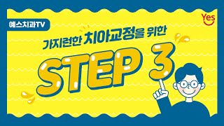 가지런한 치아교정을 위한 STEP 3 ! 💕부산치아교정 서면예스치과 💕