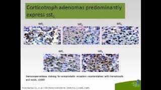 Medical Therapy in Cushing's Disease