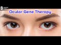 What is ocular gene therapy  dr sunita rana agarwal  doctors circle