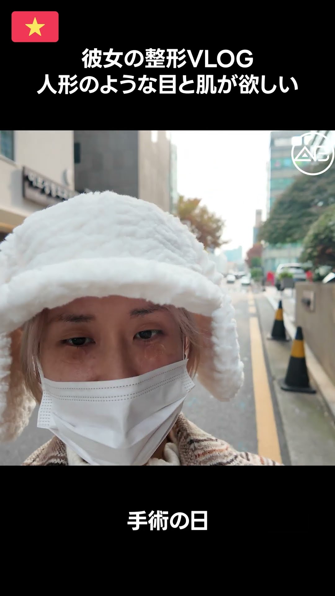 整形手術Vlog：ドールフェイスへの挑戦 | AB美容外科 #韓国整形 #美容