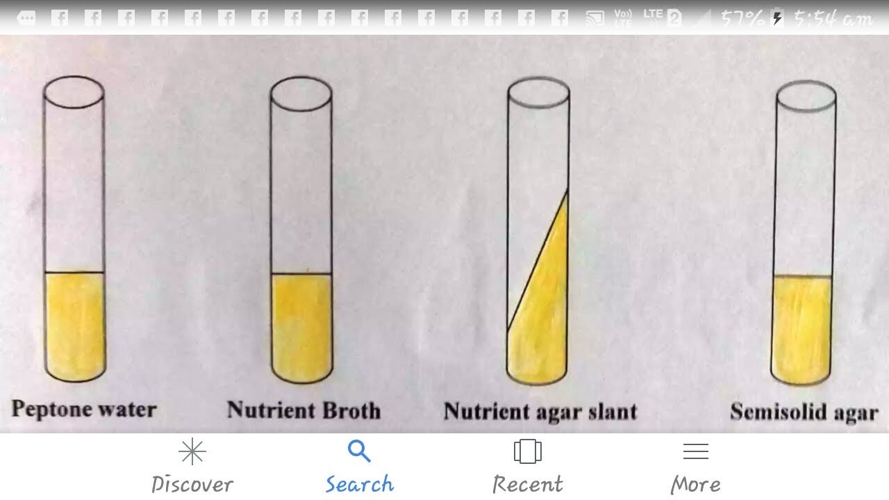 Culture media microbiology in hindi YouTube