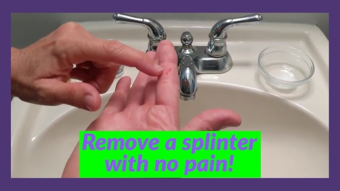 How to remove a splinter. PRID Drawing Salve 