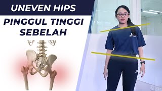 Pinggul Tinggi Sebelah?? - Uneven Hips Lateral Pelvic Tilt | Fisioterapi Indonesia (First Physio)