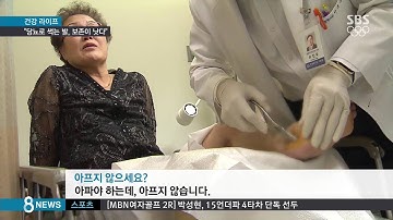 당뇨로 썩는 발…"절단 대신 보존 치료하세요" / SBS