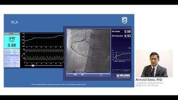 Case review: iFR Co-registration in 3 vessel disease with Dr. Arnold Seto