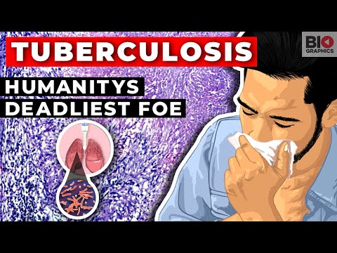 Tuberculosis: Humanity's Deadliest Foe