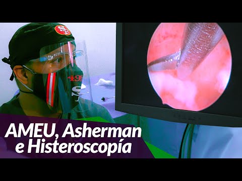 Video: ¿Puede mva causar el síndrome de Asherman?