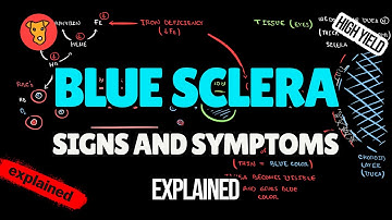 Blue Sclera EXPLAINED: Pathogenesis, Clinical Signs & Diagnosis (USMLE High-Yield Beginner’s Guide)