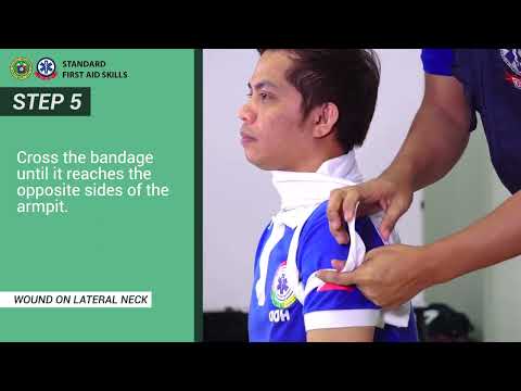 WOUND ON THE LATERAL NECK