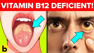 9 Warning Signs That Your Body Is Low On Vitamin B12