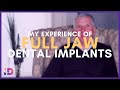 My experience with full jaw dental implants  integrated dentalcare edinburgh dentalimplants