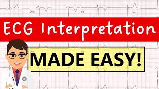How to interpret an ECG systematically | EXPLAINED CLEARLY!