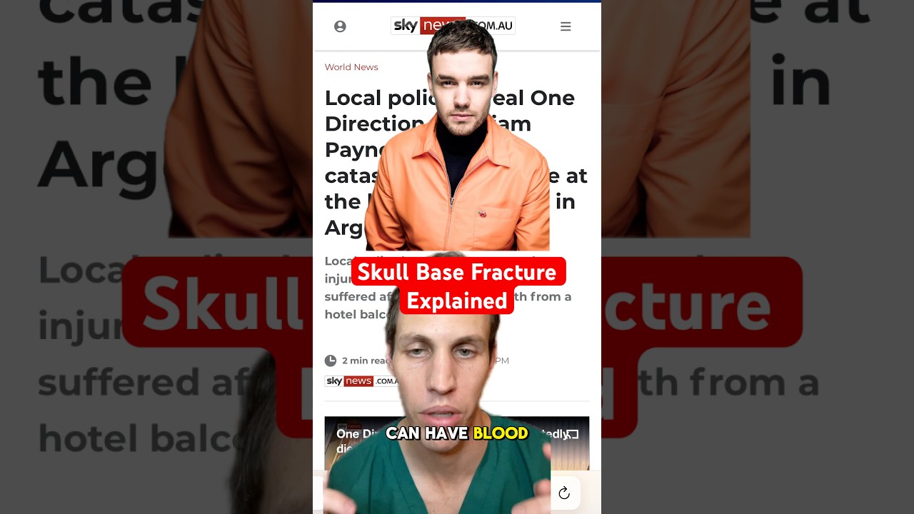 Liam Payne suffered a skull base fracture. What is that?