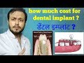 What is Dental Implant and Cost in Hindi , डेंटल इम्प्लांट क्या है ? #drvaibhavhtiwari