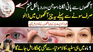 Eye Infection Jaldi Kaise Thik Kare | Eye Infection Gharelu ilaj | Eye Infection Dr Sharafat Ali New