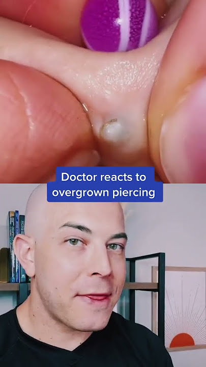 Doctor reacts to an overgrown piercing pop! #piercing #pimplepop #cystpop #dermreacts
