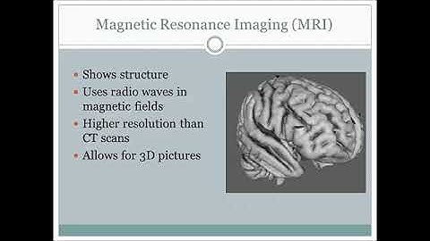 General Psychology Mini-Lecture 3: Neuroimaging