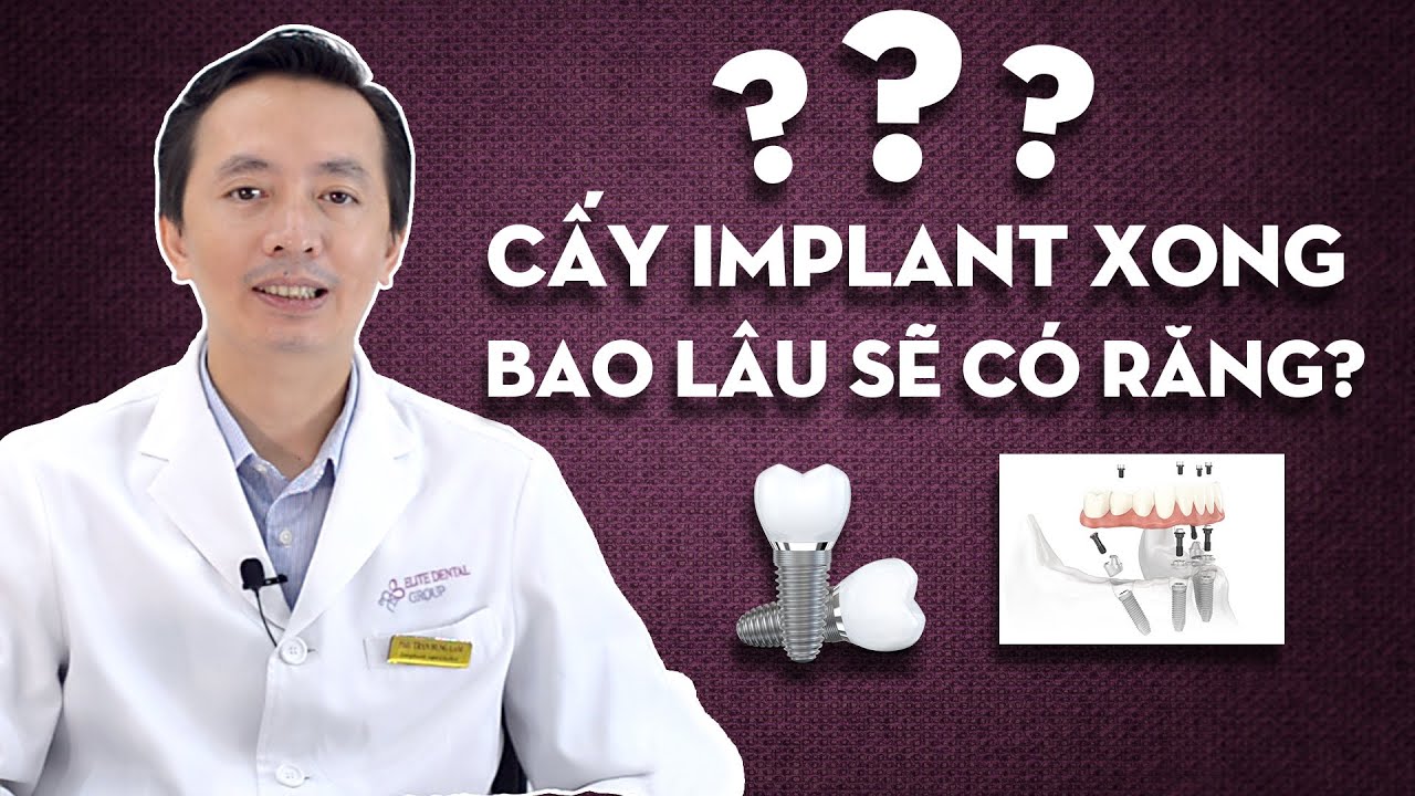 Outline Video Trồng răng Implant | Cấy ghép Implant xong bao lâu có răng | Nha khoa Elite