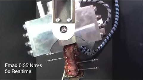 Robotic Spine Test: Pure Moment Non-Anatomical Plane / A-P View