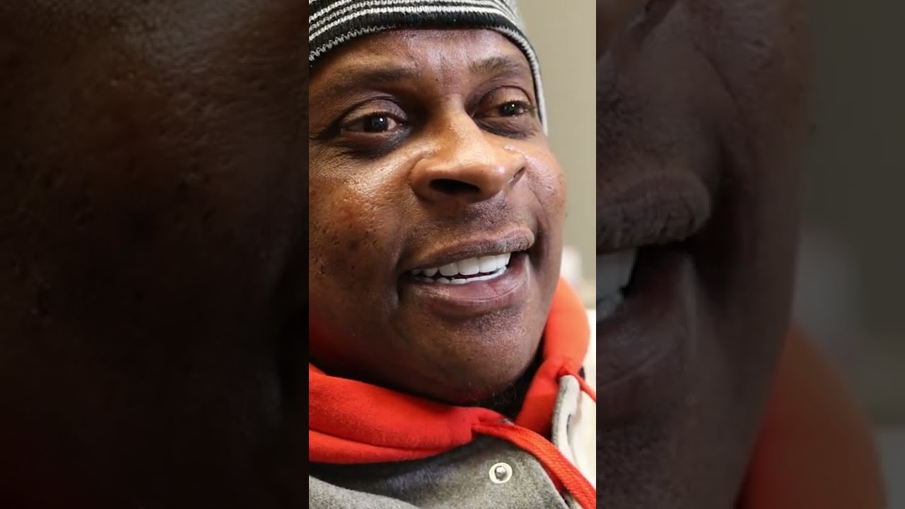 Check out this smile transformation after Nuvia's Permanent Teeth in 24-Hours! 🦷💙