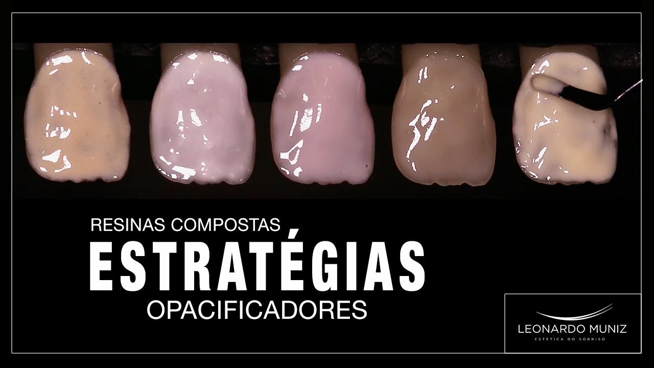 Opacificadores | Leonardo Muniz