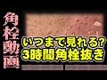 【 角栓抜き動画 】3時間ゆっくり見続ける角栓抜き動画～A video of a blackhead remover that lasts for 3 hours