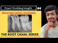 Working length determination vital pulp calcified canalsdental jibasic root canal series part 4